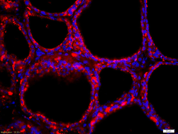 NIS Antibody in Immunohistochemistry (Paraffin) (IHC (P))