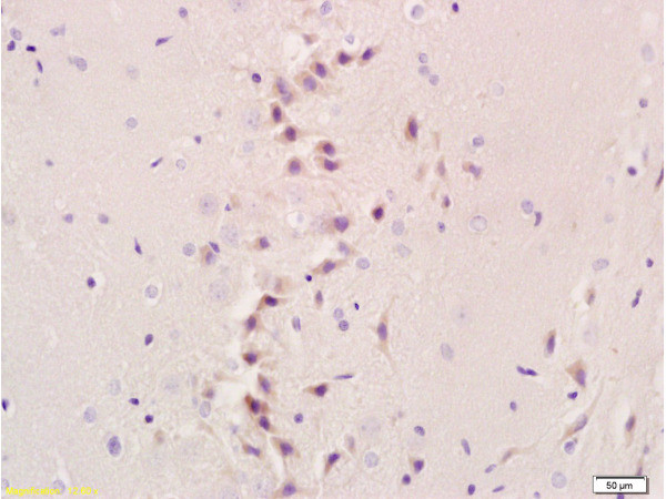 NIS Antibody in Immunohistochemistry (Paraffin) (IHC (P))