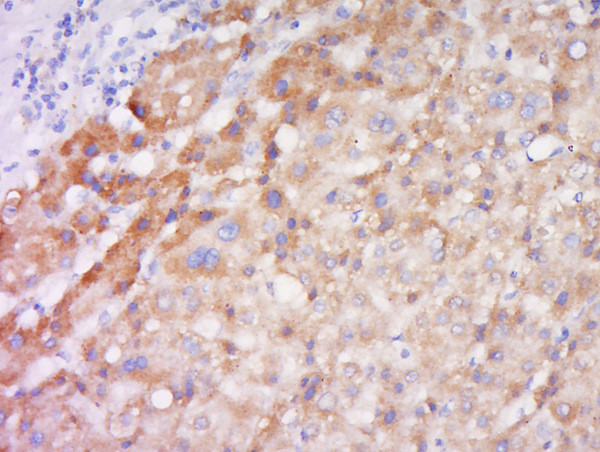 TSLP human Antibody in Immunohistochemistry (Paraffin) (IHC (P))