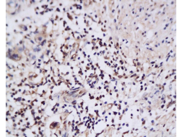 NAIF1 Antibody in Immunohistochemistry (Paraffin) (IHC (P))