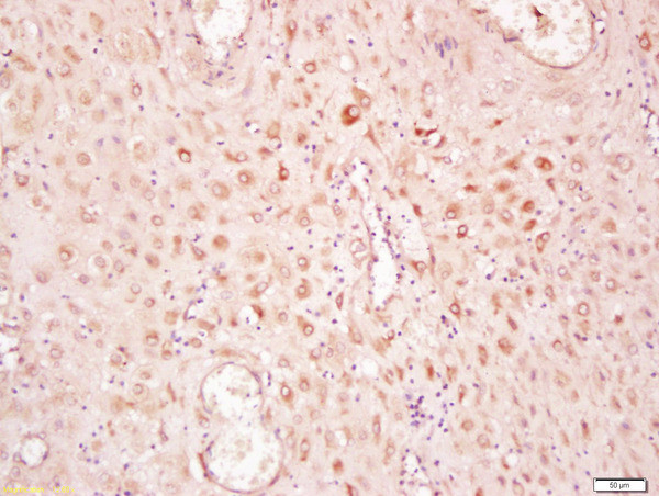 Phospho-SMAD2 (Ser465) Antibody in Immunohistochemistry (Paraffin) (IHC (P))