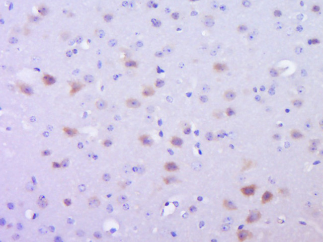 Phospho-SMAD2 (Ser465) Antibody in Immunohistochemistry (Paraffin) (IHC (P))