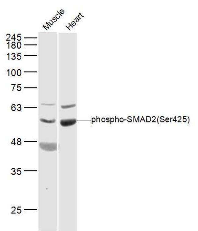 Phospho-SMAD2 (Ser465) Antibody in Western Blot (WB)