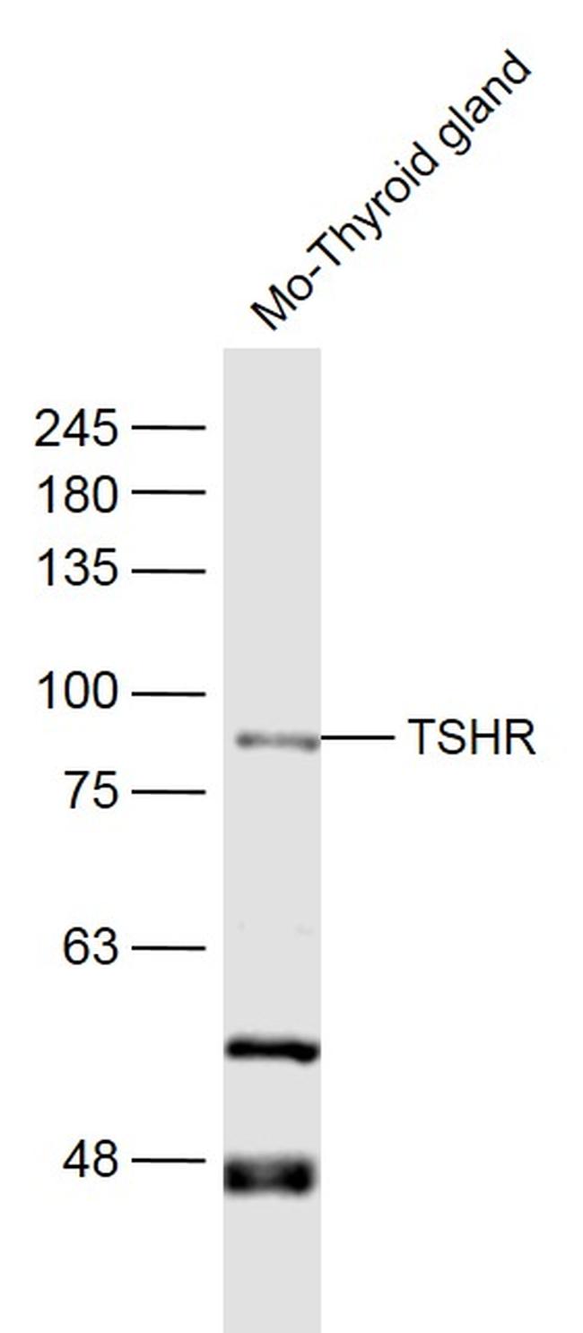 TSHR Antibody in Western Blot (WB)