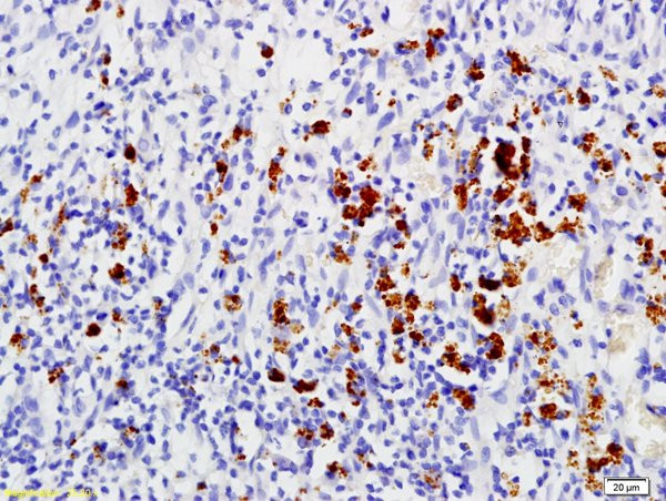 MMP-1 Antibody in Immunohistochemistry (Paraffin) (IHC (P))