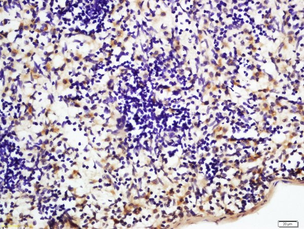 NFKB p65 Antibody in Immunohistochemistry (Paraffin) (IHC (P))