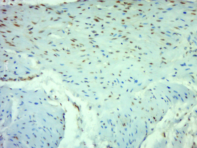 NFKB p65 Antibody in Immunohistochemistry (Paraffin) (IHC (P))