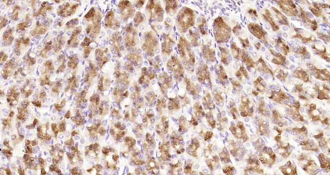 NFKB p65 Antibody in Immunohistochemistry (Paraffin) (IHC (P))