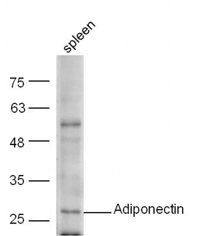 Adiponectin Antibody in Western Blot (WB)