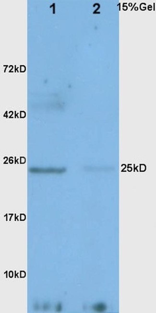 Adiponectin Antibody in Western Blot (WB)