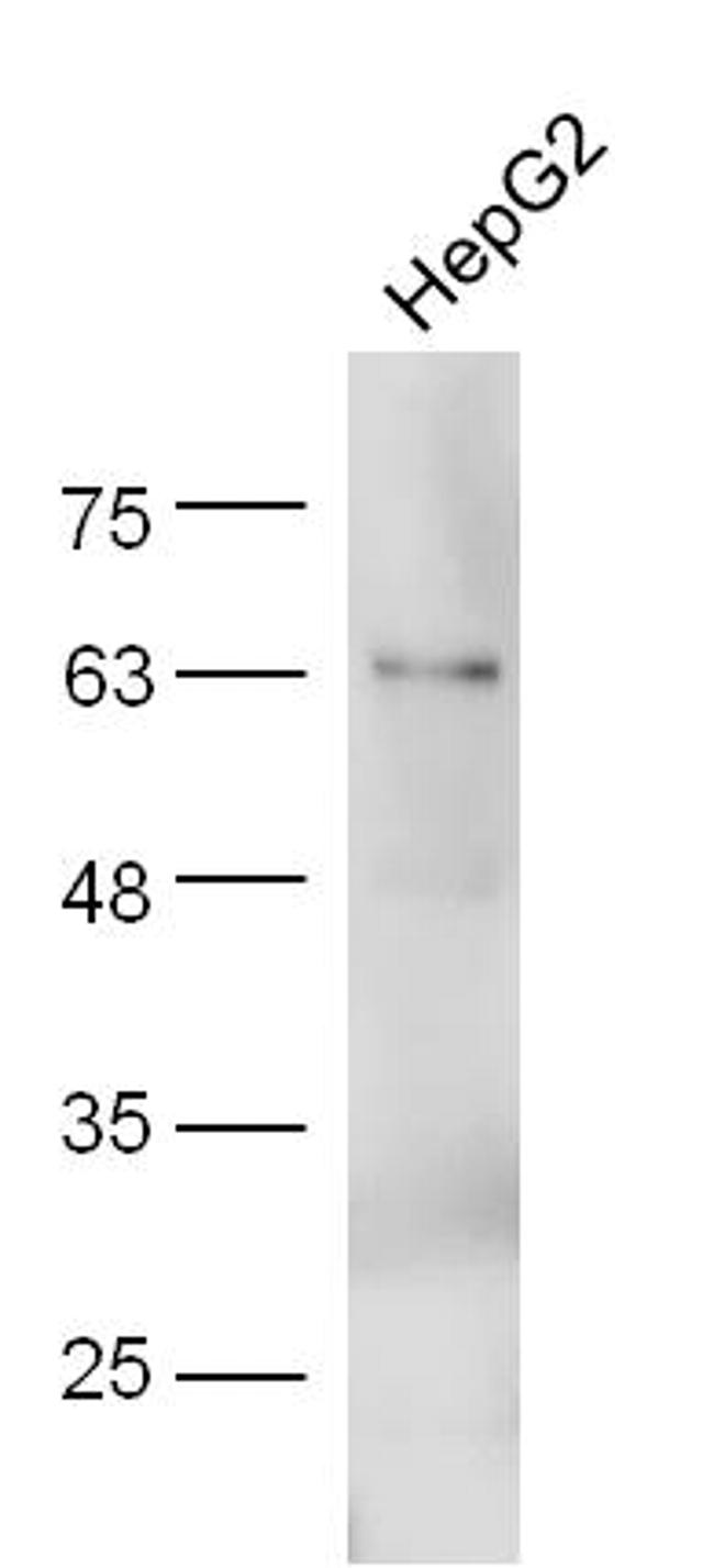 Adiponectin Antibody in Western Blot (WB)