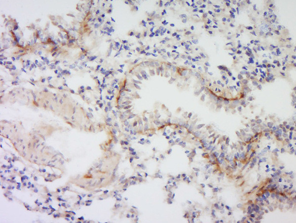 VSIG4 Antibody in Immunohistochemistry (Paraffin) (IHC (P))