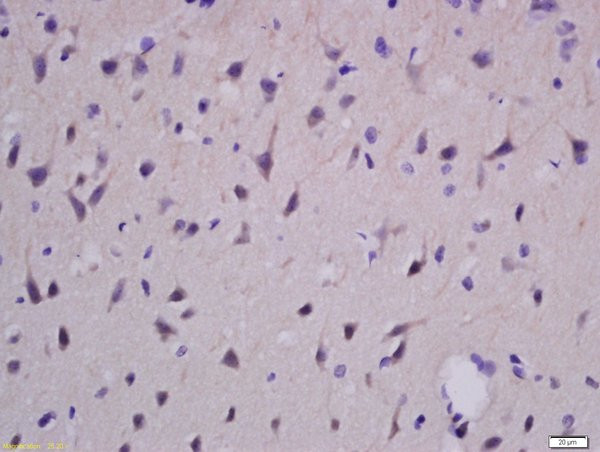 EphA2 Antibody in Immunohistochemistry (Paraffin) (IHC (P))