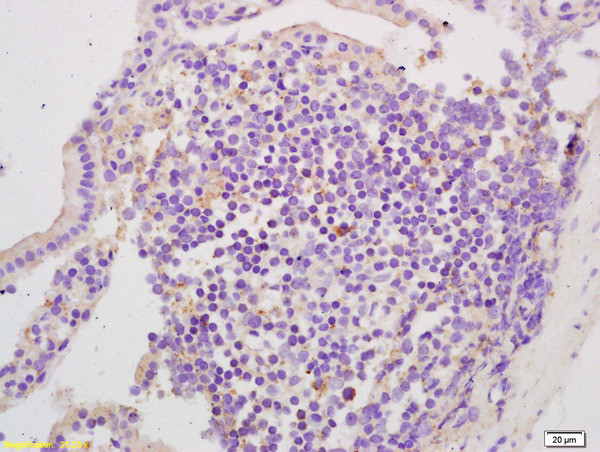 EphA2 Antibody in Immunohistochemistry (Paraffin) (IHC (P))