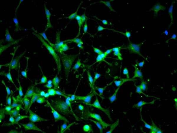 Dnmt3a Antibody in Immunocytochemistry (ICC/IF)