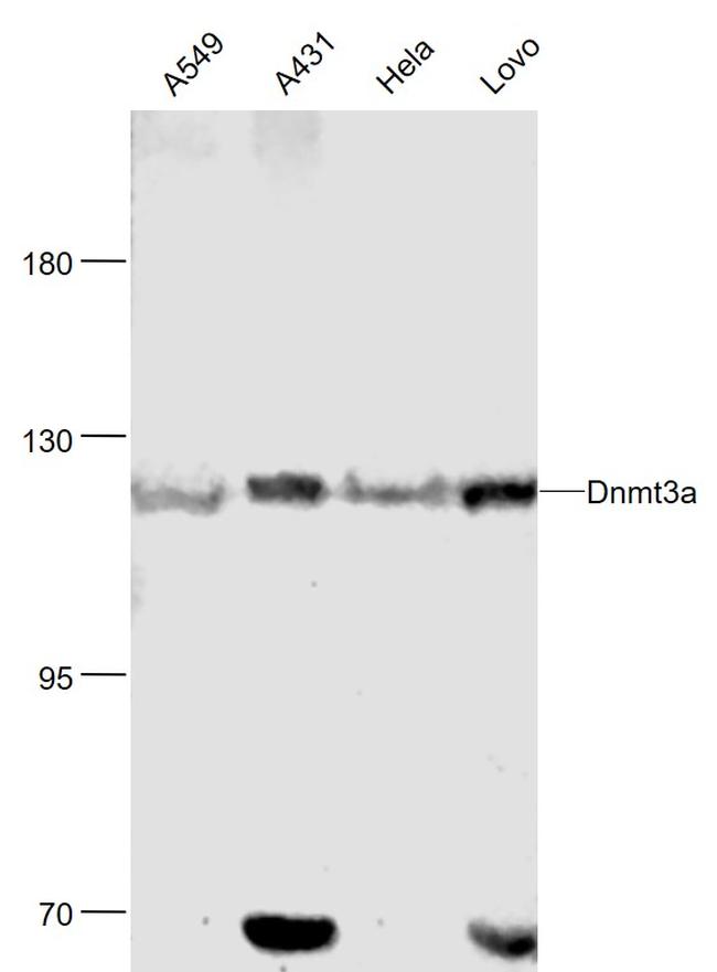 Dnmt3a Antibody in Western Blot (WB)