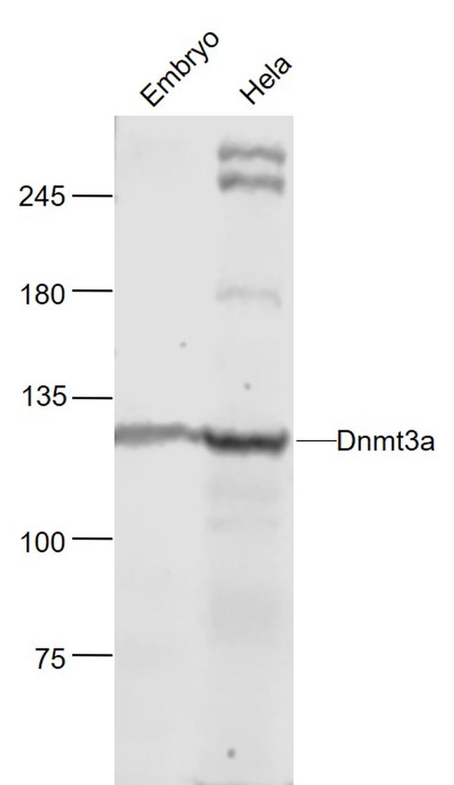 Dnmt3a Antibody in Western Blot (WB)