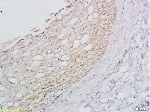 ADRB1 Antibody in Immunohistochemistry (Paraffin) (IHC (P))