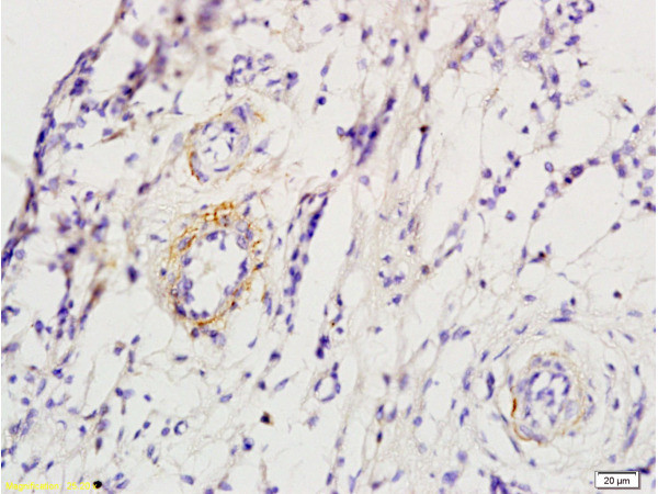 ADRB1 Antibody in Immunohistochemistry (Paraffin) (IHC (P))