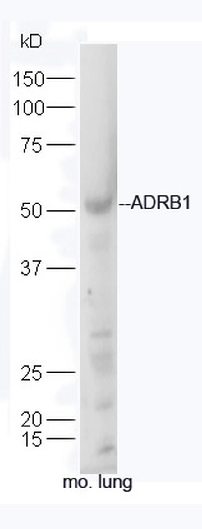 ADRB1 Antibody in Western Blot (WB)