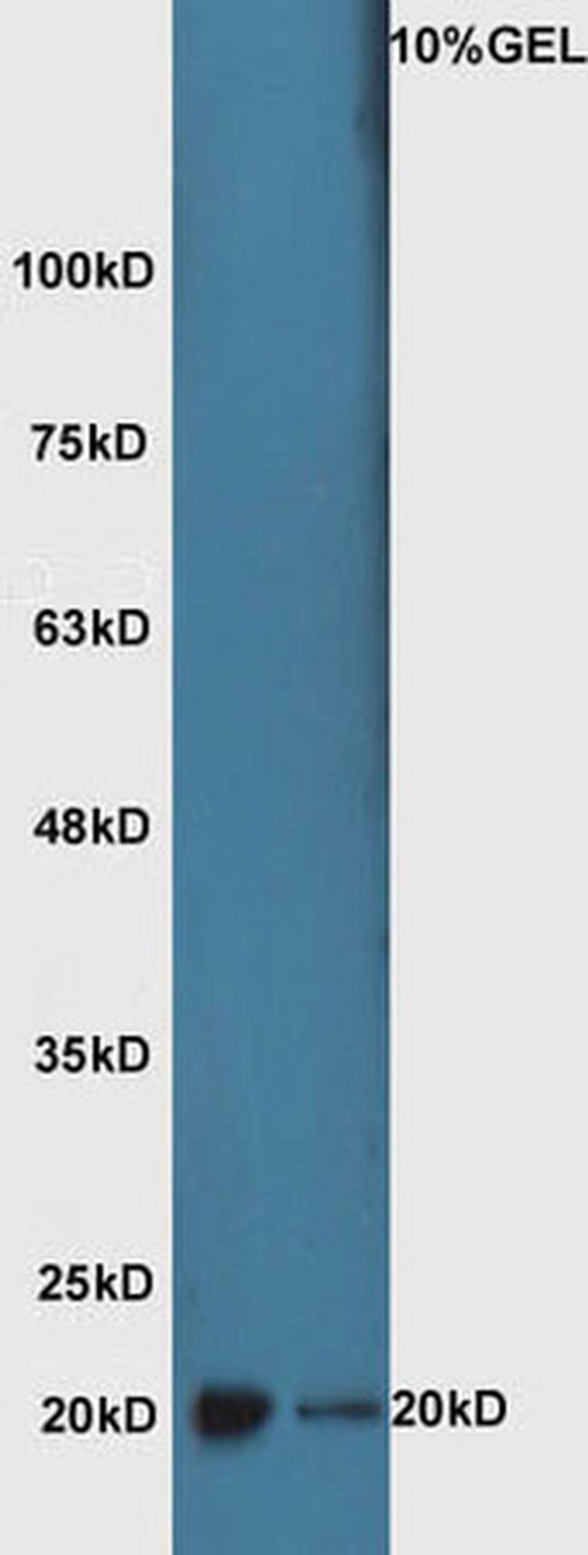 ATF3 Antibody in Western Blot (WB)