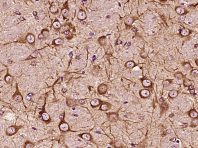 5 lipoxygenase Antibody in Immunohistochemistry (Paraffin) (IHC (P))