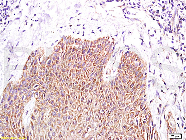 PPAR gamma Antibody in Immunohistochemistry (Paraffin) (IHC (P))