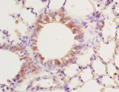 PPAR gamma Antibody in Immunohistochemistry (Paraffin) (IHC (P))