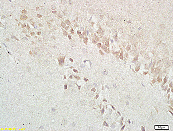 GABABR1 Antibody in Immunohistochemistry (Paraffin) (IHC (P))