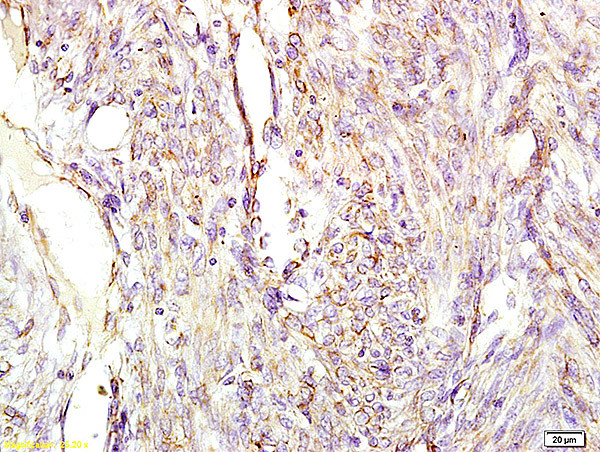 Chromogranin A Antibody in Immunohistochemistry (Paraffin) (IHC (P))