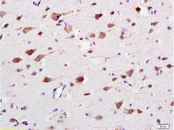 CaMK2 Antibody in Immunohistochemistry (Paraffin) (IHC (P))