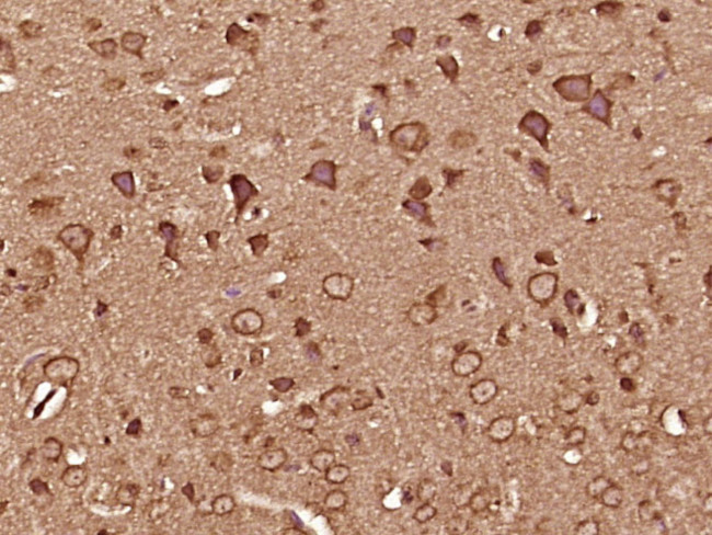 CaMK2 Antibody in Immunohistochemistry (Paraffin) (IHC (P))