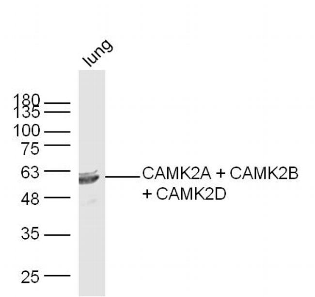 CaMK2 Antibody in Western Blot (WB)