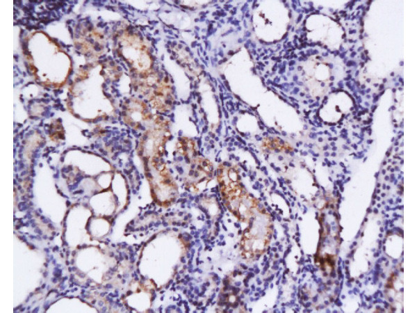 SCF Antibody in Immunohistochemistry (Paraffin) (IHC (P))