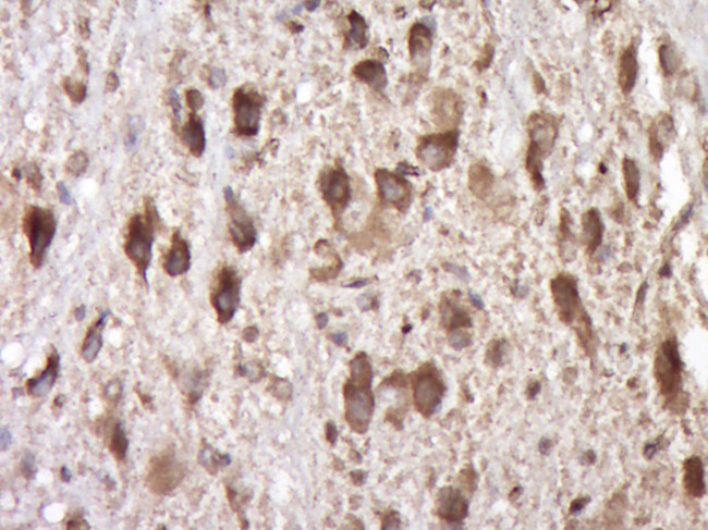 SCF Antibody in Immunohistochemistry (Paraffin) (IHC (P))