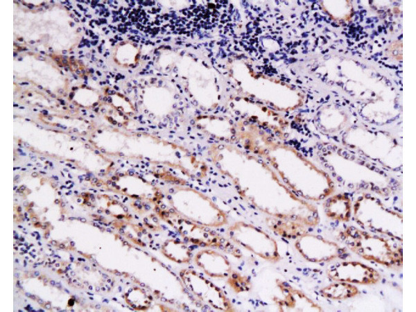 COL18A1 Antibody in Immunohistochemistry (Paraffin) (IHC (P))