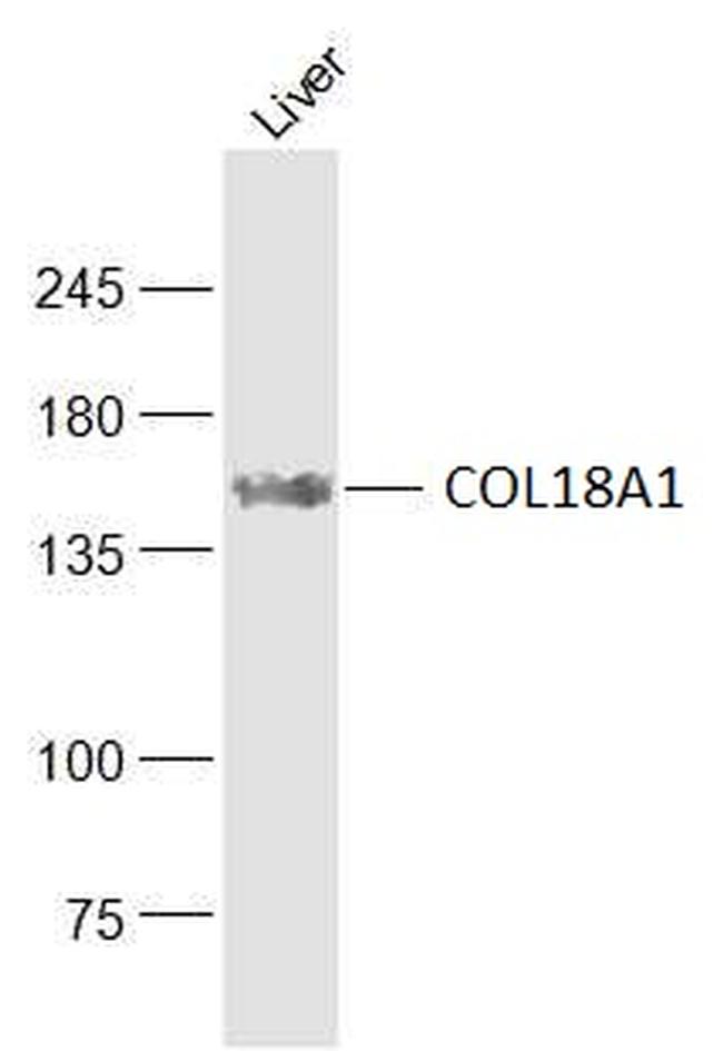 COL18A1 Antibody in Western Blot (WB)