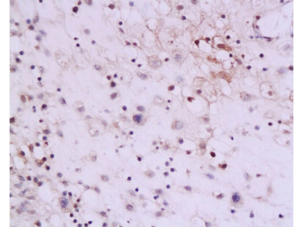 IL-13 Antibody in Immunohistochemistry (Paraffin) (IHC (P))