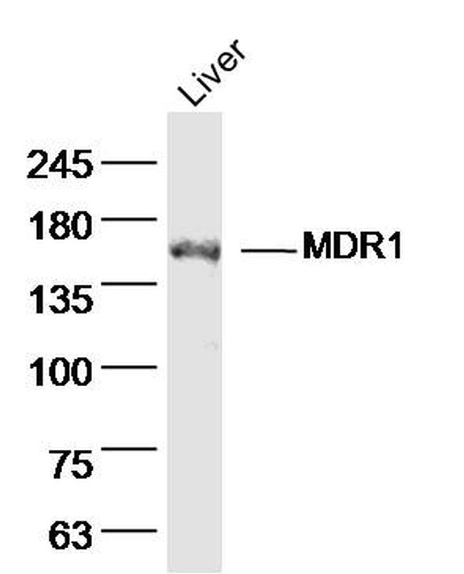 MDR1 Antibody in Western Blot (WB)