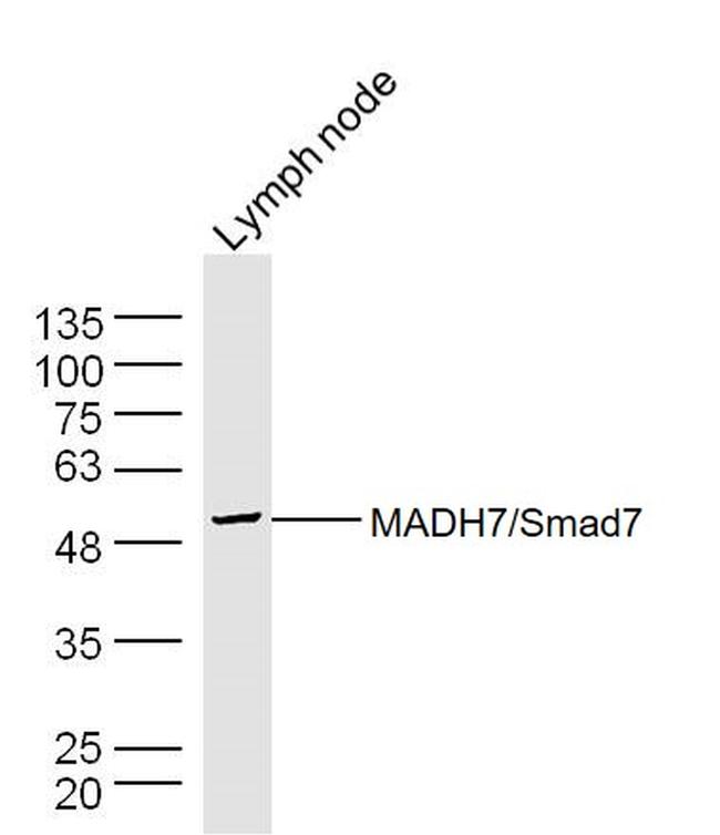 Smad7 Antibody in Western Blot (WB)