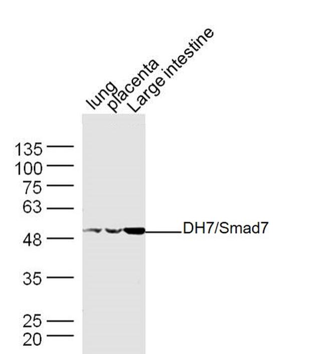 Smad7 Antibody in Western Blot (WB)