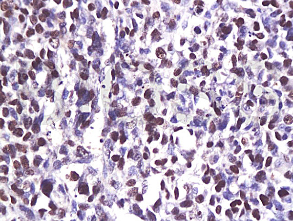 CDK6 Antibody in Immunohistochemistry (Paraffin) (IHC (P))