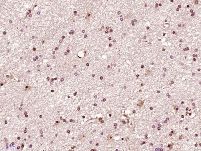 CDK6 Antibody in Immunohistochemistry (Paraffin) (IHC (P))