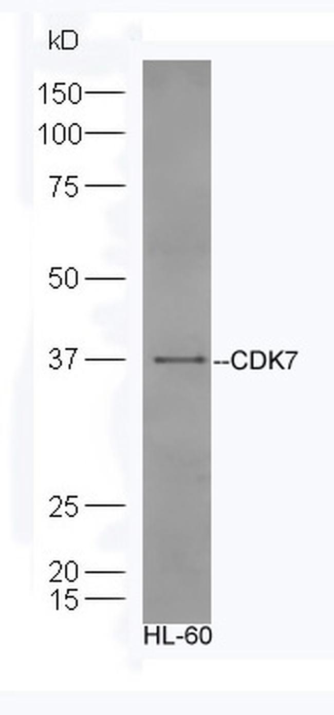 CDK7 Antibody in Western Blot (WB)