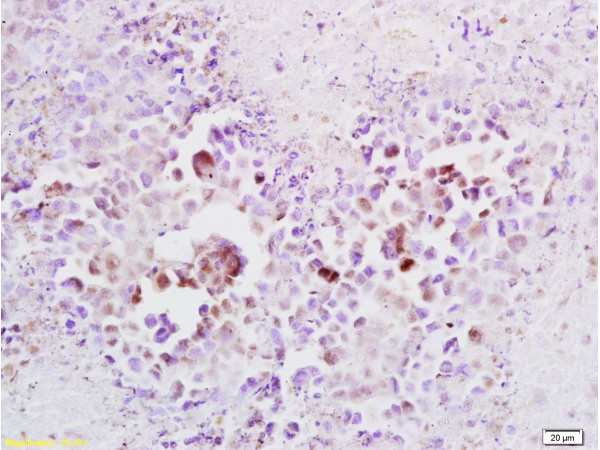 Cyclin A2 Antibody in Immunohistochemistry (Paraffin) (IHC (P))