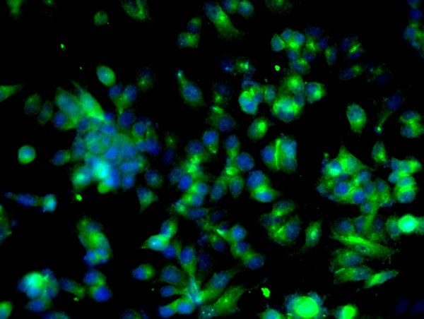 Cyclin B1 Antibody in Immunocytochemistry (ICC/IF)