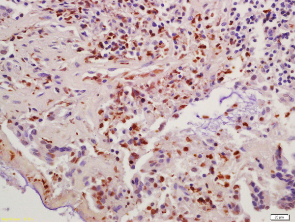 Cyclin B1 Antibody in Immunohistochemistry (Paraffin) (IHC (P))