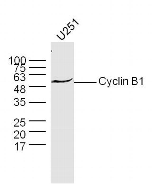 Cyclin B1 Antibody in Western Blot (WB)