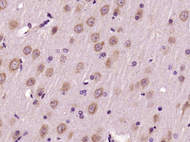 Dynamin 2 Antibody in Immunohistochemistry (Paraffin) (IHC (P))