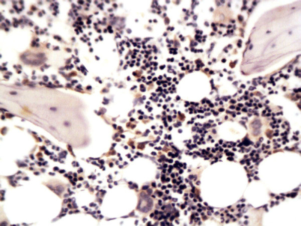 MMP-13 Antibody in Immunohistochemistry (Paraffin) (IHC (P))